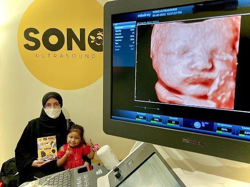 Klinik Ultrasound Terbaik di Rawang untuk Pemeriksaan Optimum