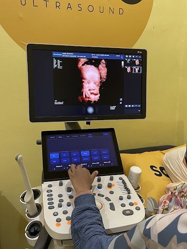 SONOBEE ULTRASOUND DUNGUN