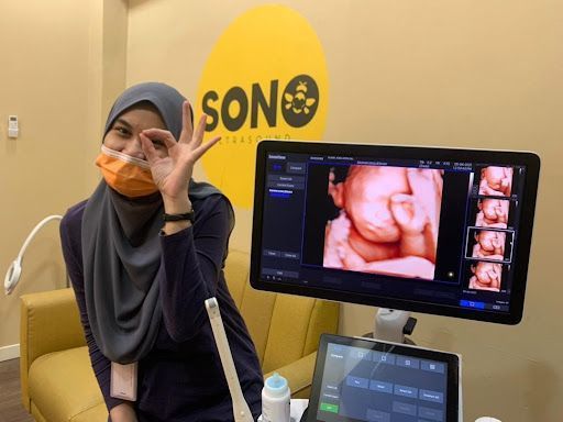 SONOBEE ULTRASOUND DURIAN TUNGGAL