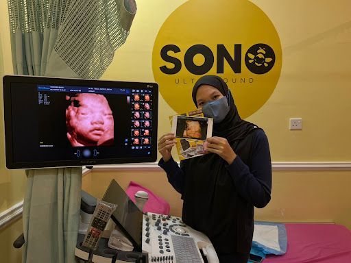 SONOBEE ULTRASOUND KAMUNTING