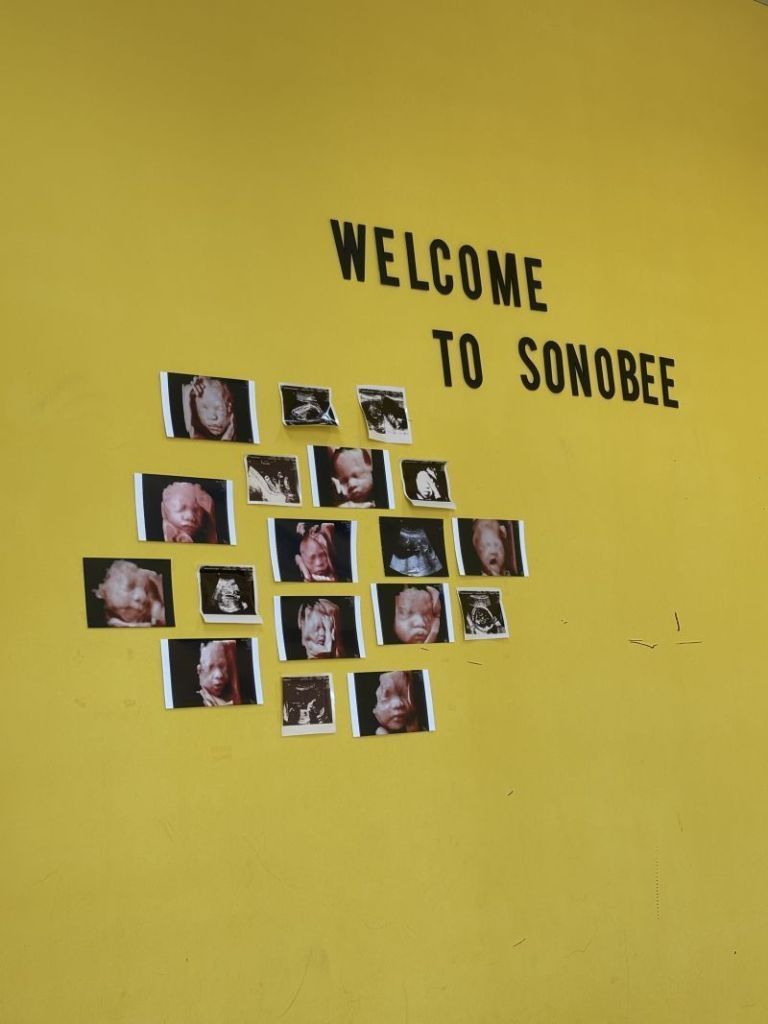 SONOBEE ULTRASOUND KUCHING