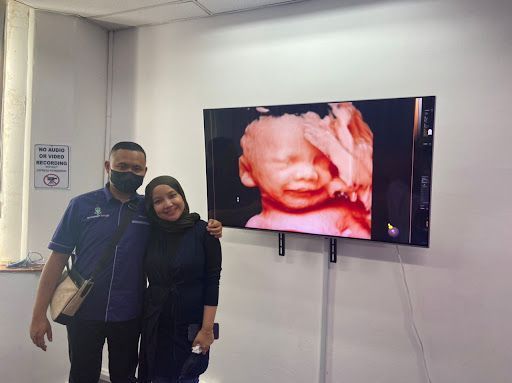 Sonovison Ultrasound Ipoh